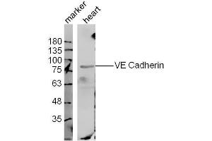 Mouse heart lysates probed with VE Cadherin Polyclonal Antibody, unconjugated  at 1:300 overnight at 4°C followed by a conjugated secondary antibody at 1:10000 for 60 minutes at 37°C.