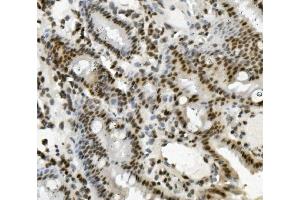 IHC analysis of PRDM5 using anti-PRDM5 antibody (ABIN7600853).