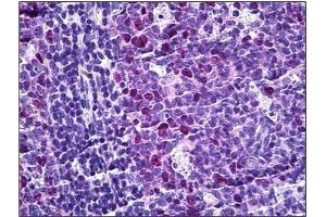 Human Tonsil: Formalin-Fixed, Paraffin-Embedded (FFPE) (TPX2 antibody  (Internal Region))