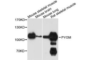 Western blot analysis of extracts of various cell lines, using PYGM antibody. (PYGM antibody)