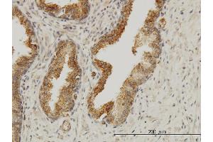 Immunoperoxidase of monoclonal antibody to AAAS on formalin-fixed paraffin-embedded human prostate. (Adracalin antibody  (AA 1-100))