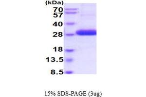 UL16 Binding Protein 2 (ULBP2) (AA 26-216) protein (His tag)