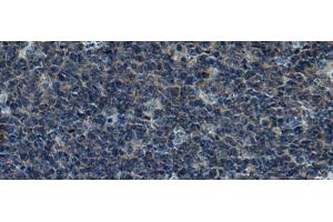 Immunohistochemistry of paraffin-embedded Human tonsil tissue using CUL5 Polyclonal Antibody at dilution of 1:55(x200) (Cullin 5 antibody)