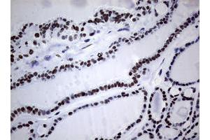 Image no. 1 for anti-Nibrin (NBN) (AA 183-460) antibody (ABIN1491056) (Nibrin antibody  (AA 183-460))