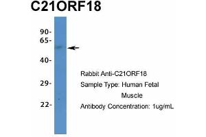 Host:  Rabbit  Target Name:  C21ORF18  Sample Type:  Human Fetal Muscle  Antibody Dilution:  1.