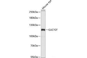 GUCY2F antibody