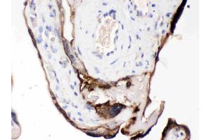 CDCP1 was detected in paraffin-embedded sections of human placenta tissues using rabbit anti- CDCP1 Antigen Affinity purified polyclonal antibody (Catalog # ) at 1 µg/mL. (CDCP1 antibody  (AA 582-667))