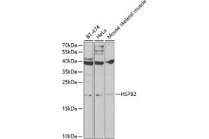 Western blot analysis of extracts of various cell lines, using HSPB2 antibody (ABIN6131082, ABIN6142054, ABIN6142055 and ABIN6219505) at 1:1000 dilution. (HSPB2 antibody  (AA 1-182))