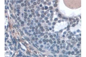 Detection of KIBRA in Mouse Ovary Tissue using Polyclonal Antibody to Kidney And Brain Protein (KIBRA) (WWC1 antibody  (AA 847-1094))