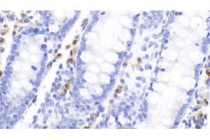 Detection of CTLA4 in Human Colon Tissue using Monoclonal Antibody to Cytotoxic T-Lymphocyte Associated Antigen 4 (CTLA4) (CTLA4 antibody  (AA 52-211))