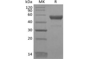 Western Blotting (WB) image for Triggering Receptor Expressed On Myeloid Cells 5 (TREM5) protein (Fc Tag) (ABIN7319809) (CD300LB Protein (Fc Tag))