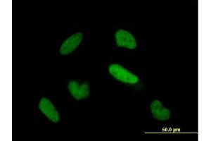 Immunofluorescence of purified MaxPab antibody to TIAL1 on HeLa cell. (TIAL1 antibody  (AA 1-252))