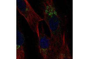 Immunofluorescent staining of human cell line BJ shows localization to the Golgi apparatus.