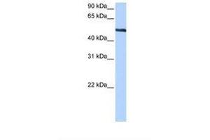 Image no. 1 for anti-Thyroid Hormone Receptor Interactor 6 (TRIP6) (AA 160-209) antibody (ABIN6738769) (TRIP6 antibody  (AA 160-209))
