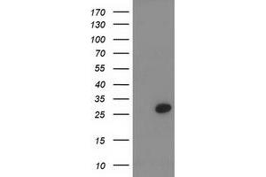 HEK293T cells were transfected with the pCMV6-ENTRY control (Left lane) or pCMV6-ENTRY PNMT (Right lane) cDNA for 48 hrs and lysed. (PNMT antibody)