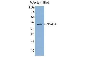 Western Blotting (WB) image for anti-Bleomycin Hydrolase (BLMH) (AA 213-447) antibody (ABIN1175598) (BLMH antibody  (AA 213-447))