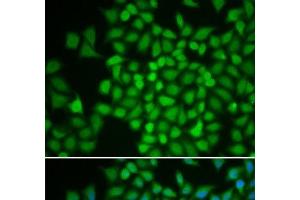 Immunofluorescence analysis of HeLa cells using COPS5 Polyclonal Antibody (COPS5 antibody)