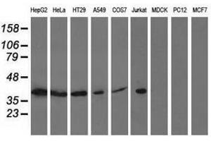 Image no. 2 for anti-Acetyl-CoA Acetyltransferase 2 (ACAT2) antibody (ABIN1496405)