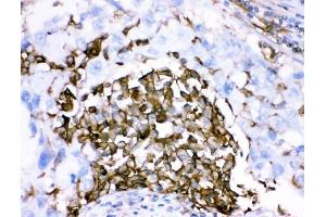 IHC analysis of CD18/ITGB2 using anti-CD18/ITGB2 antibody (ABIN3043260). (Integrin beta 2 antibody  (AA 404-769))