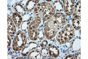 Immunohistochemical staining of paraffin-embedded prostate tissue using anti-TPMT mouse monoclonal antibody. (TPMT antibody)