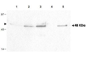 Western blot using CCNB1 (phospho S126) polyclonal antibody  shows detection of a band ~48 kDa corresponding to phosphorylated human CCNB1 (arrowheads) in various whole cell lysates. (Cyclin B1 antibody  (pSer126))