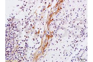 Collagen Type V antibody  (AA 1450-1500)