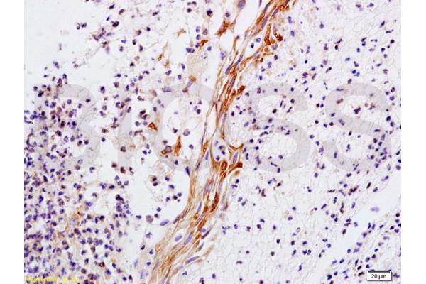 Collagen Type V antibody  (AA 1450-1500)