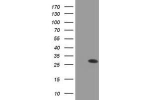 Western Blotting (WB) image for anti-Proteasome (Prosome, Macropain) Subunit, beta Type, 9 (Large Multifunctional Peptidase 2) (PSMB9) (AA 21-219) antibody (ABIN1491190)