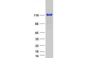 Validation with Western Blot (AFAP1L2 Protein (Transcript Variant 2) (Myc-DYKDDDDK Tag))