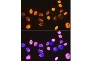 Immunofluorescence analysis of HeLa cells using DDX5 Rabbit mAb (ABIN7266698) at dilution of 1:100 (40x lens).