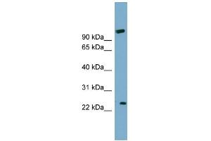 WB Suggested Anti-ARL8B Antibody Titration: 0. (ARL8B antibody  (Middle Region))