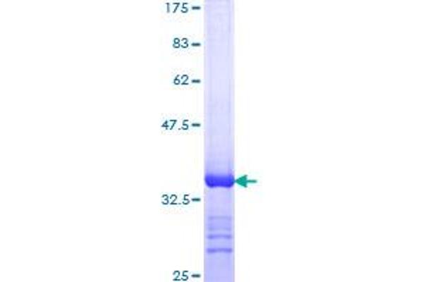 DHX9 Protein (AA 1-90) (GST tag)