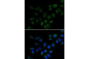 Immunofluorescence analysis of MCF7 cells using BMP15 antibody (ABIN6127524, ABIN6137593, ABIN6137594 and ABIN6223163). (BMP15 antibody  (AA 143-392))
