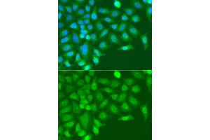 Immunofluorescence analysis of A549 cell using TARBP2 antibody. (TRBP antibody)