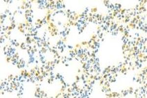 Immunohistochemistry (Paraffin-embedded Sections) (IHC (p)) image for anti-ADAM Metallopeptidase with Thrombospondin Type 1 Motif, 4 (ADAMTS4) antibody (ABIN7072947)