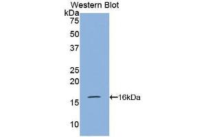 Detection of Recombinant VPREB1, Mouse using Polyclonal Antibody to Pre-B-Lymphocyte Gene 1 (VPREB1) (VPREB1 antibody  (AA 43-134))