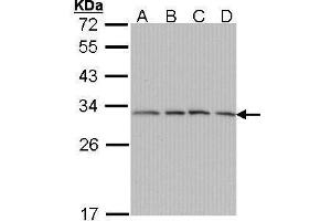 WB Image Sample (30 ug of whole cell lysate) A: A431 , B: H1299 C: Hela D: Hep G2 , 12% SDS PAGE antibody diluted at 1:1000 (PSMA7 antibody  (Center))