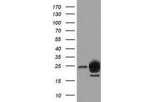 HEK293T cells were transfected with the pCMV6-ENTRY control (Left lane) or pCMV6-ENTRY LIN7B (Right lane) cDNA for 48 hrs and lysed. (LIN7B antibody)