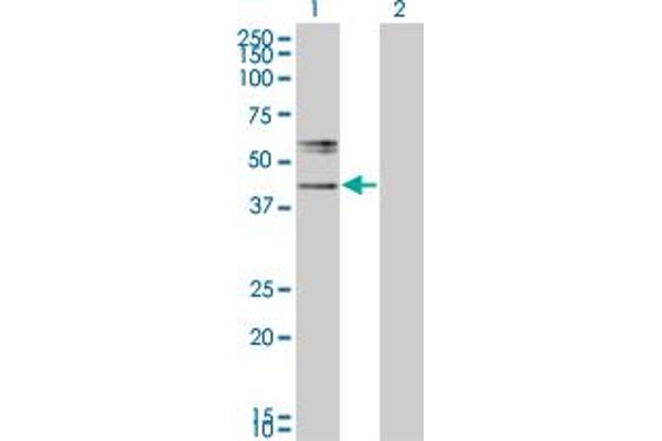B3GNT2 抗体  (AA 111-210)