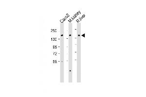 Western Blotting (WB) image for anti-ATPase, Cu++ Transporting, beta Polypeptide (ATP7B) (AA 1361-1391), (C-Term) antibody (ABIN390398)