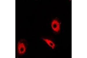 Immunofluorescent analysis of TIM staining in Hela cells. (TPI1 antibody)