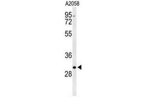 Western blot analysis of BASP1 Antibody (Center) in A2058 cell line lysates (35µg/lane). (BASP1 antibody  (Middle Region))