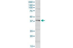 KCNN4 MaxPab rabbit polyclonal antibody. (KCNN4 antibody  (AA 1-427))