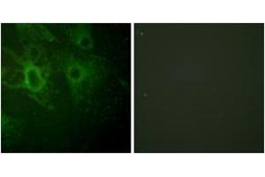 Immunofluorescence analysis of HeLa cells, using HCK (Phospho-Tyr410) Antibody. (HCK antibody  (pTyr410))