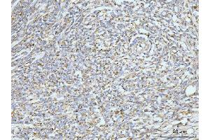 IHC analysis of GRPEL1 using anti-GRPEL1 antibody (ABIN7602643). (GRPEL1 antibody  (AA 90-217))