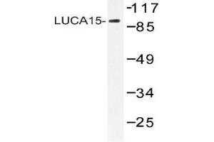 Western blot (WB) analysis of LUCA15 antibody in extracts from HHUVEC cells. (RBM5 antibody)