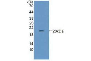 Detection of Recombinant GABPa, Human using Polyclonal Antibody to GA Binding Protein Transcription Factor Alpha (GABPa) (GABPA antibody  (AA 168-314))