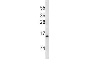 BAFF antibody western blot analysis in K562 lysate. (TNFRSF13C antibody  (AA 1-30))