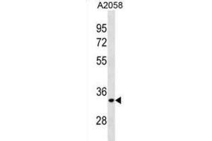 Western Blotting (WB) image for anti-ELOVL Fatty Acid Elongase 3 (ELOVL3) antibody (ABIN3001188) (ELOVL3 antibody)