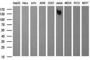 Image no. 2 for anti-Protein tyrosine Phosphatase, Receptor Type, C (PTPRC) antibody (ABIN1497330) (CD45 antibody)